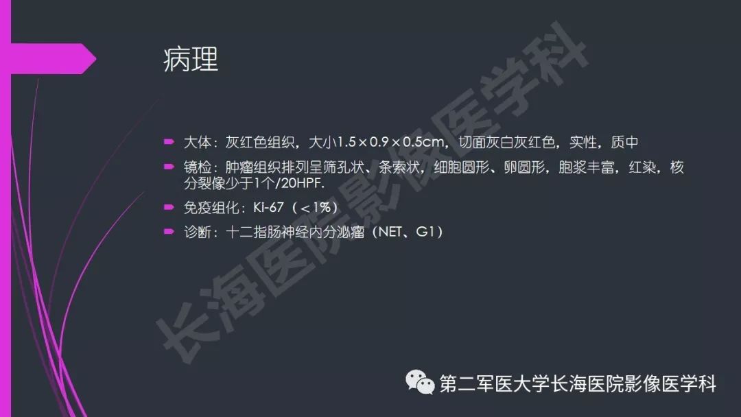 【PPT】肠道神经内分泌肿瘤