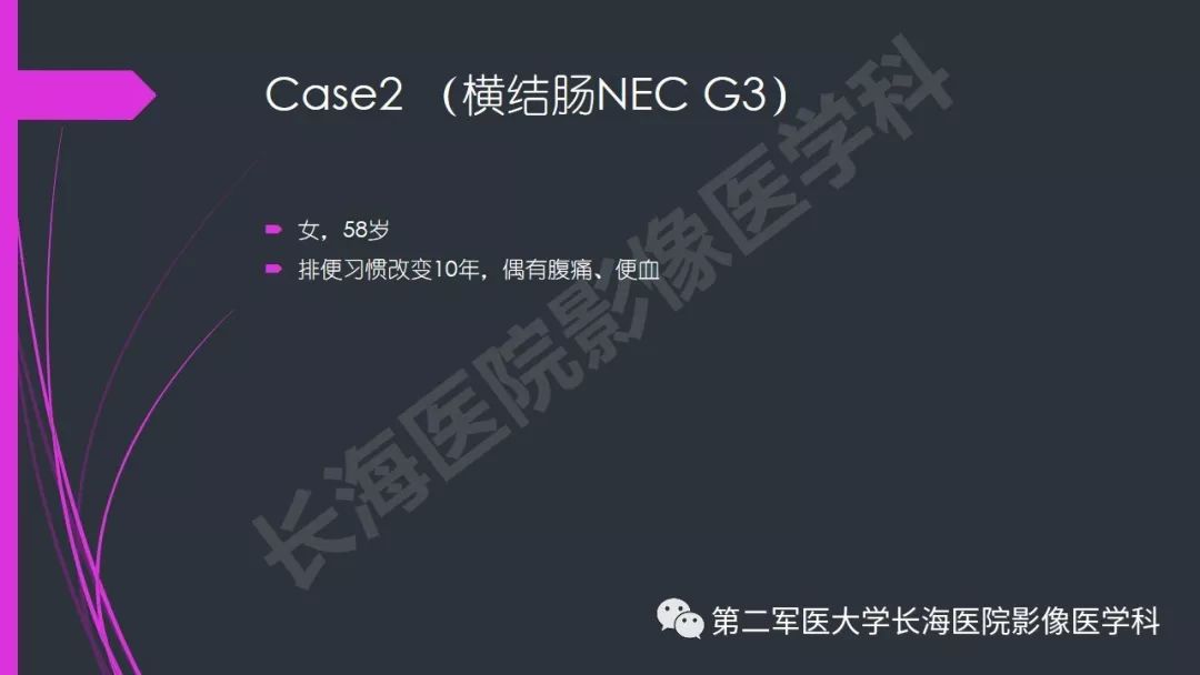 【PPT】肠道神经内分泌肿瘤