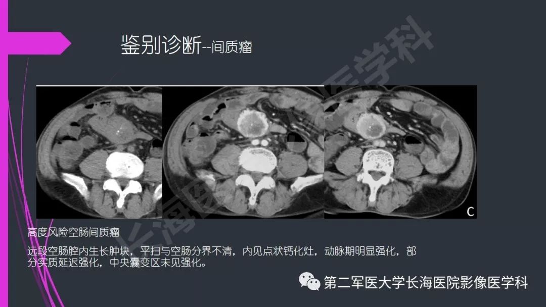 【PPT】肠道神经内分泌肿瘤