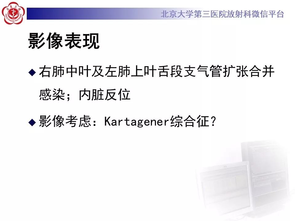 【病例】Kartagener