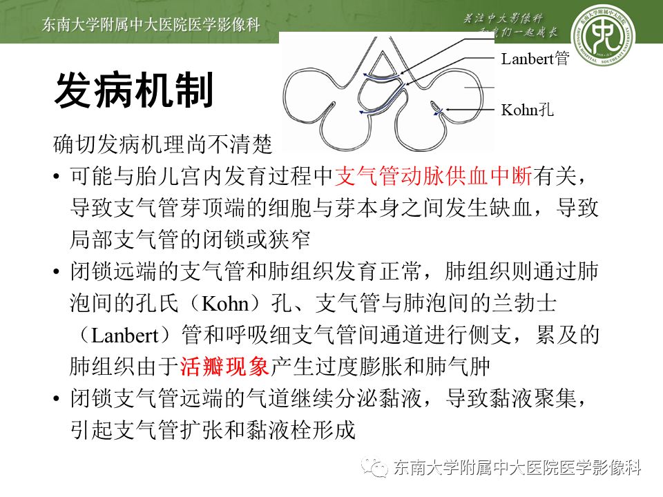 【病例】先天性支气管闭锁2例CT影像