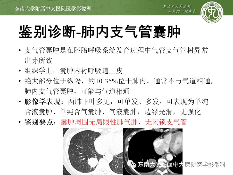 【病例】先天性支气管闭锁2例CT影像