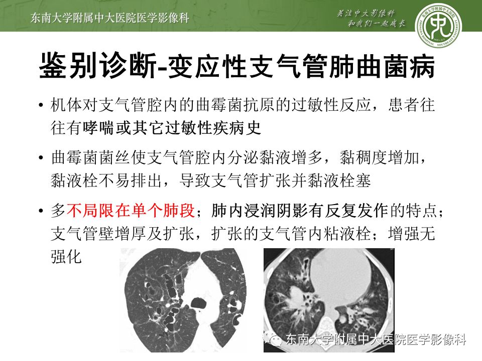 【病例】先天性支气管闭锁2例CT影像