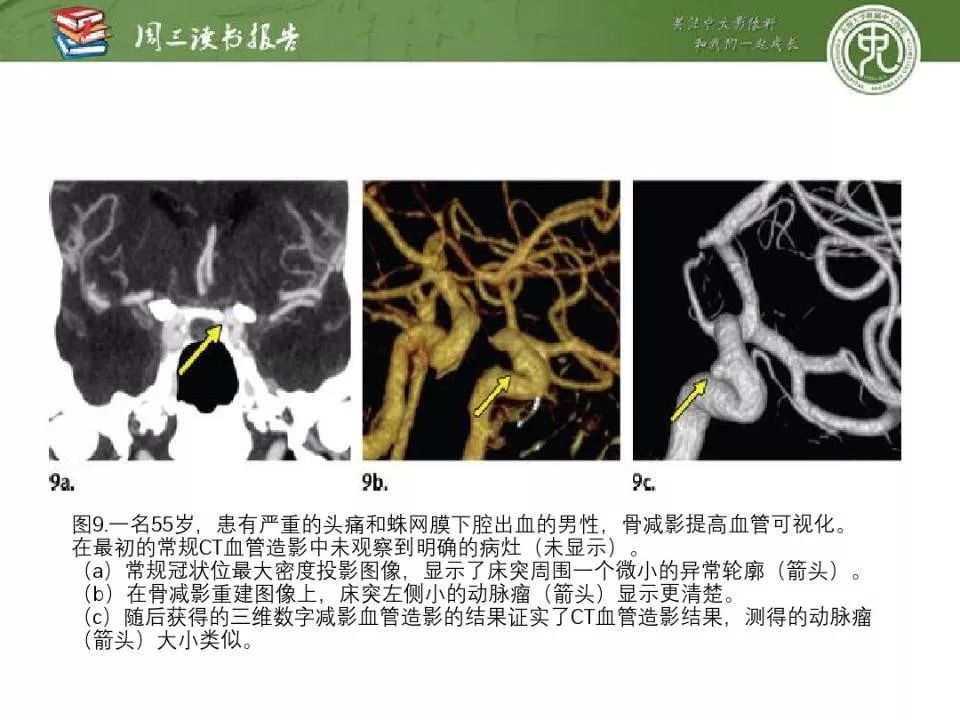 【PPT】急诊神经影像的双能CT成像