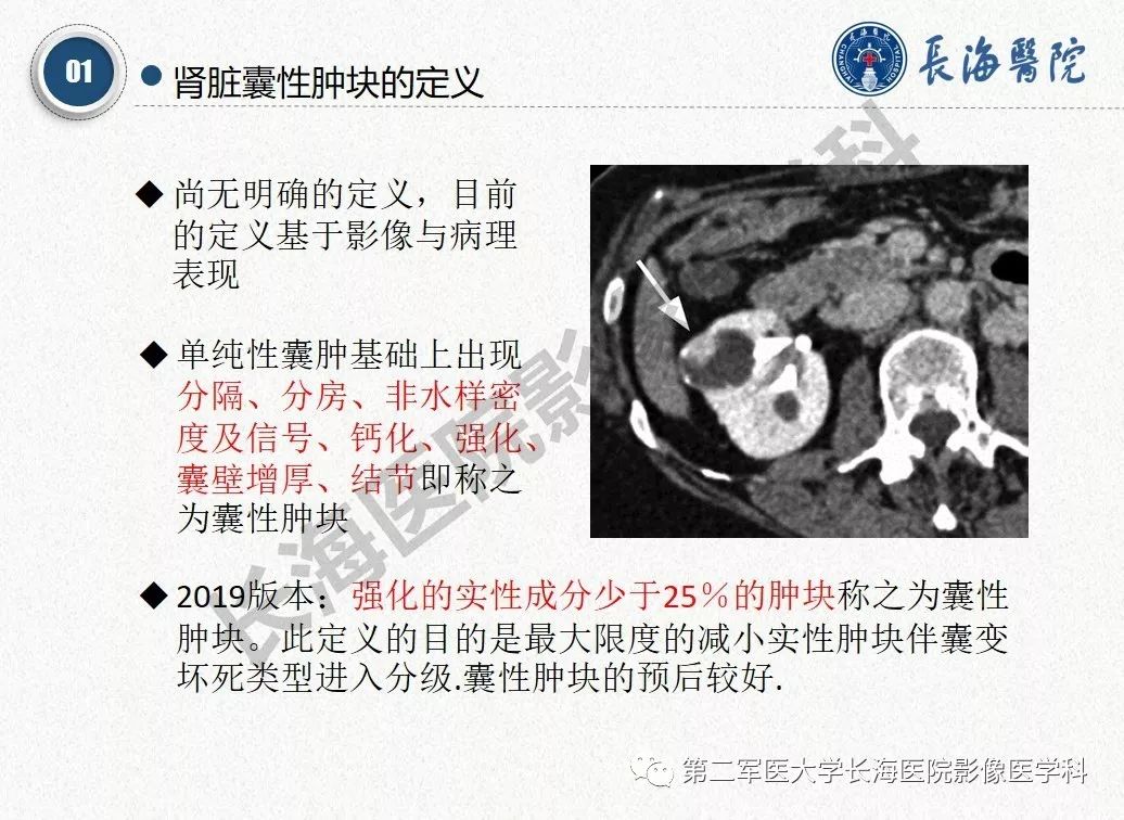 【PPT】肾脏囊性肿块的Bosniak分级,2019版本
