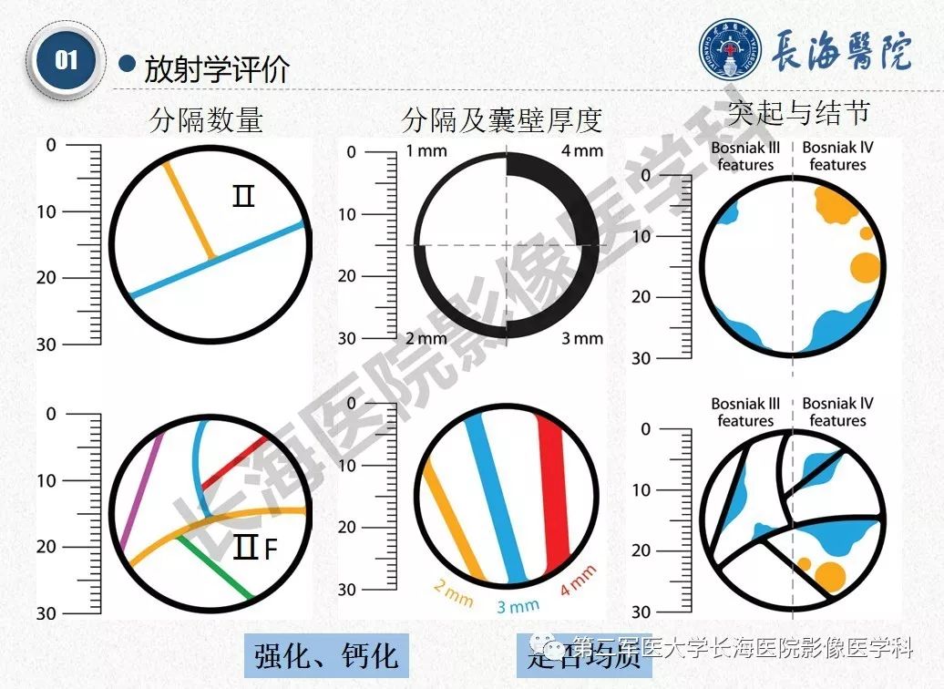 【PPT】肾脏囊性肿块的Bosniak分级,2019版本