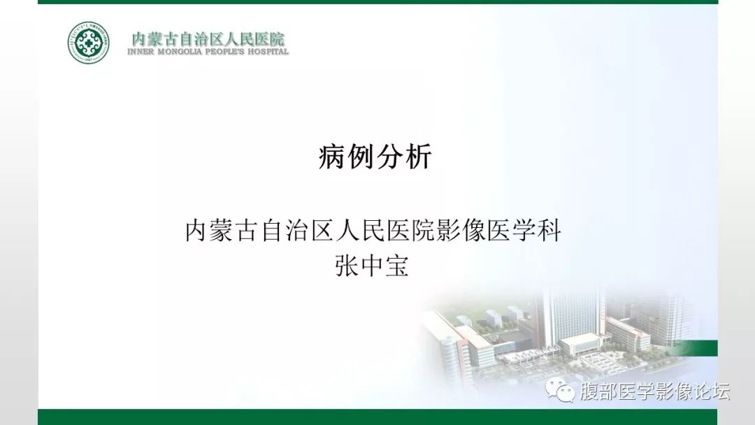 【病例】右侧髂窝腹膜外孤立性纤维瘤1例CT
