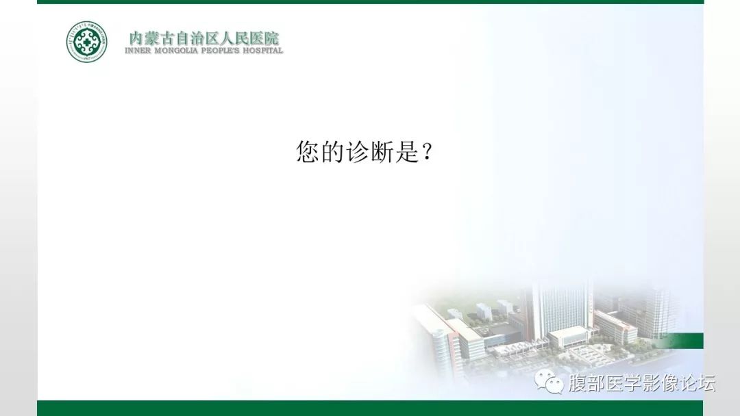 【病例】右侧髂窝腹膜外孤立性纤维瘤1例CT