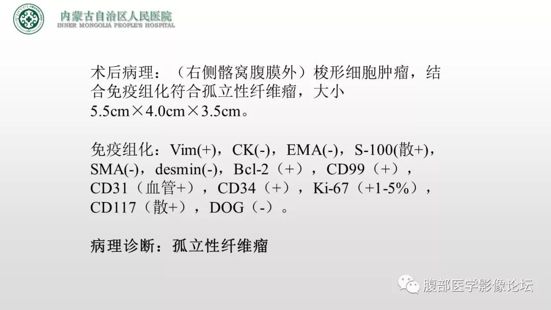 【病例】右侧髂窝腹膜外孤立性纤维瘤1例CT