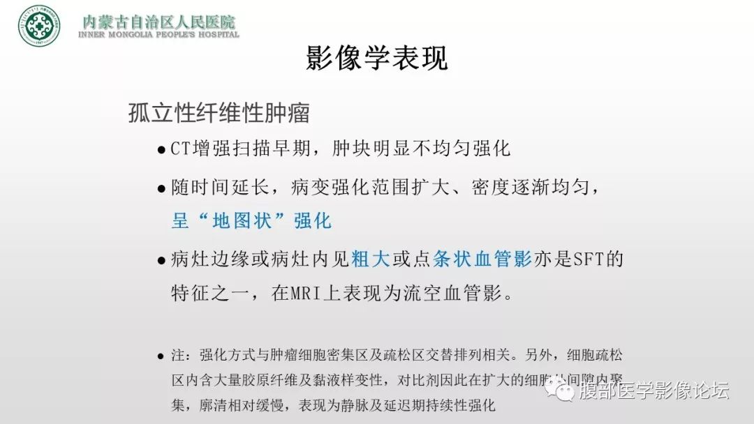 【病例】右侧髂窝腹膜外孤立性纤维瘤1例CT