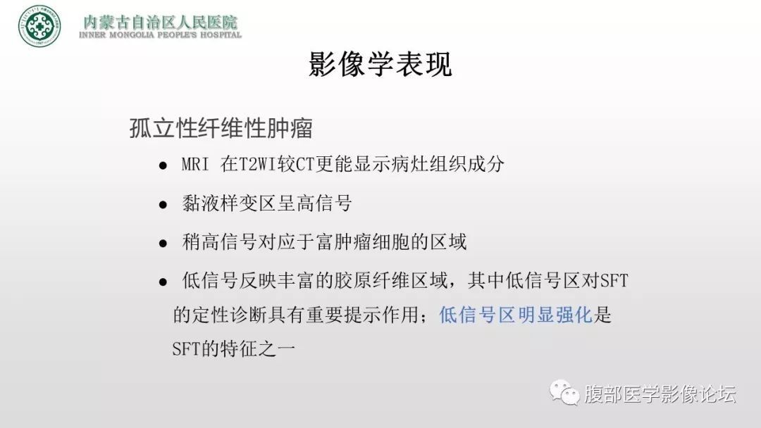 【病例】右侧髂窝腹膜外孤立性纤维瘤1例CT