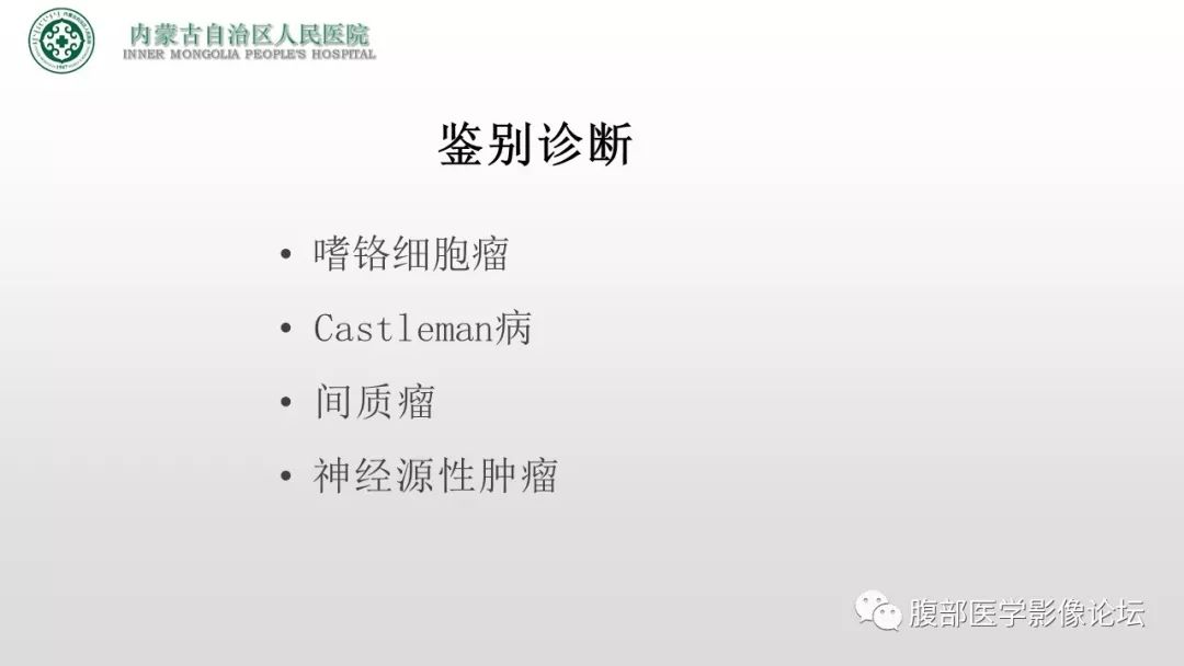 【病例】右侧髂窝腹膜外孤立性纤维瘤1例CT