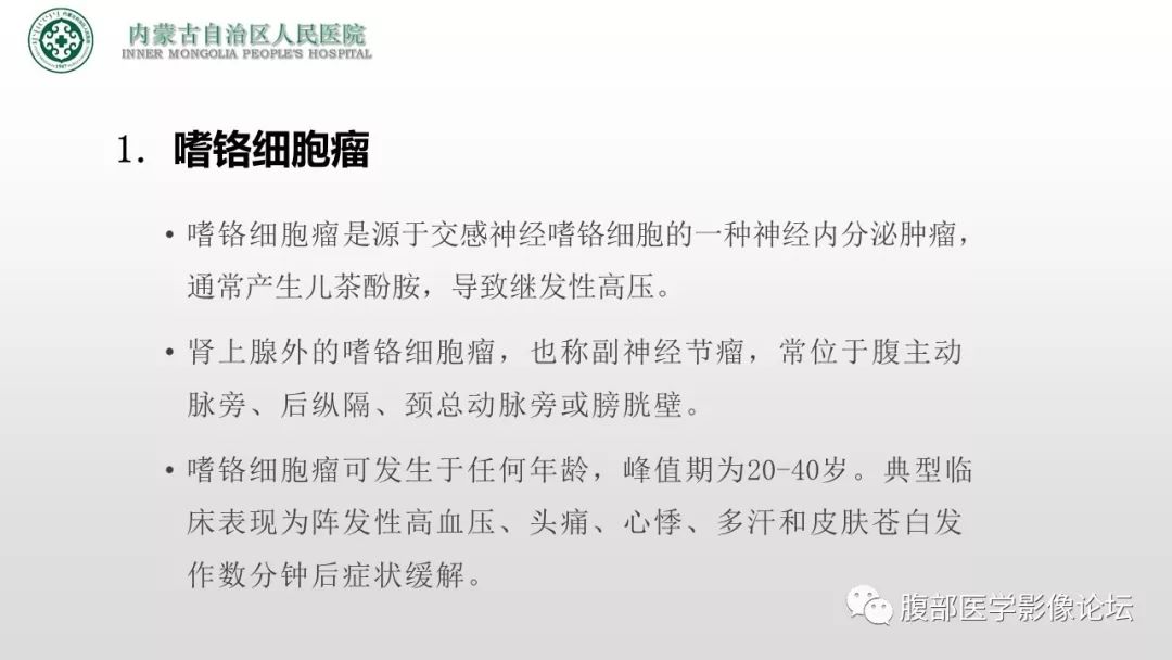 【病例】右侧髂窝腹膜外孤立性纤维瘤1例CT