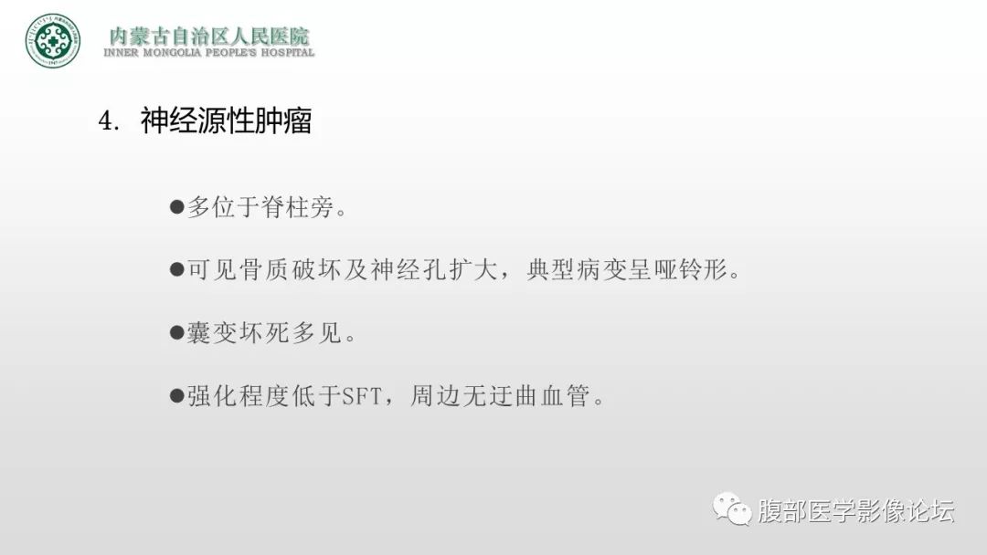 【病例】右侧髂窝腹膜外孤立性纤维瘤1例CT