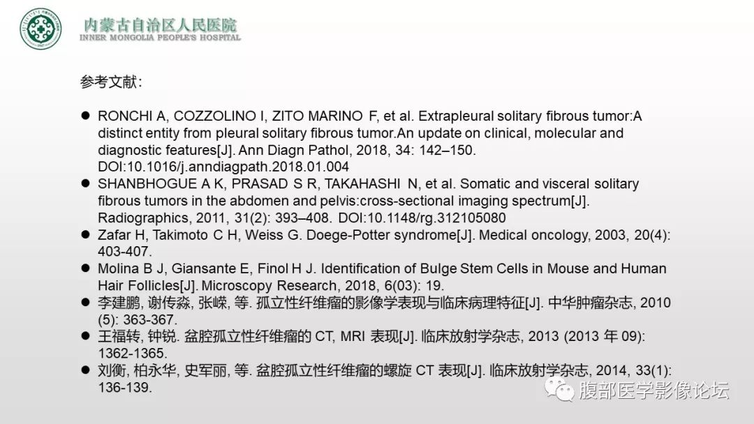 【病例】右侧髂窝腹膜外孤立性纤维瘤1例CT