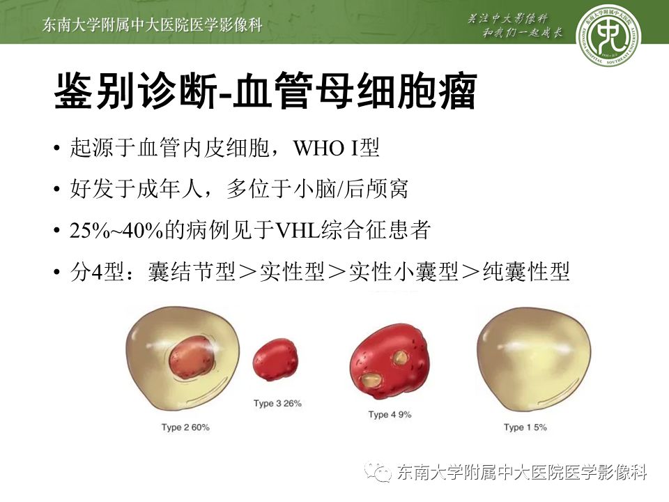 【病例】颅内血管外皮细胞瘤1例MR