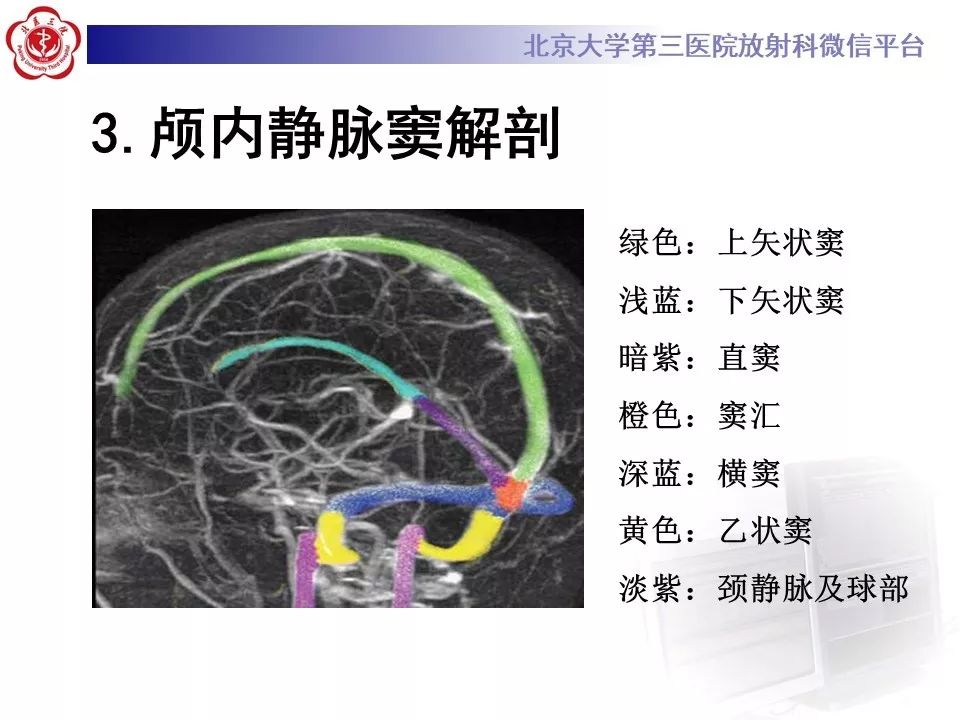 【病例】静脉窦血栓形成1例CT及MR影像