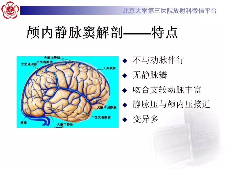 【病例】静脉窦血栓形成1例CT及MR影像