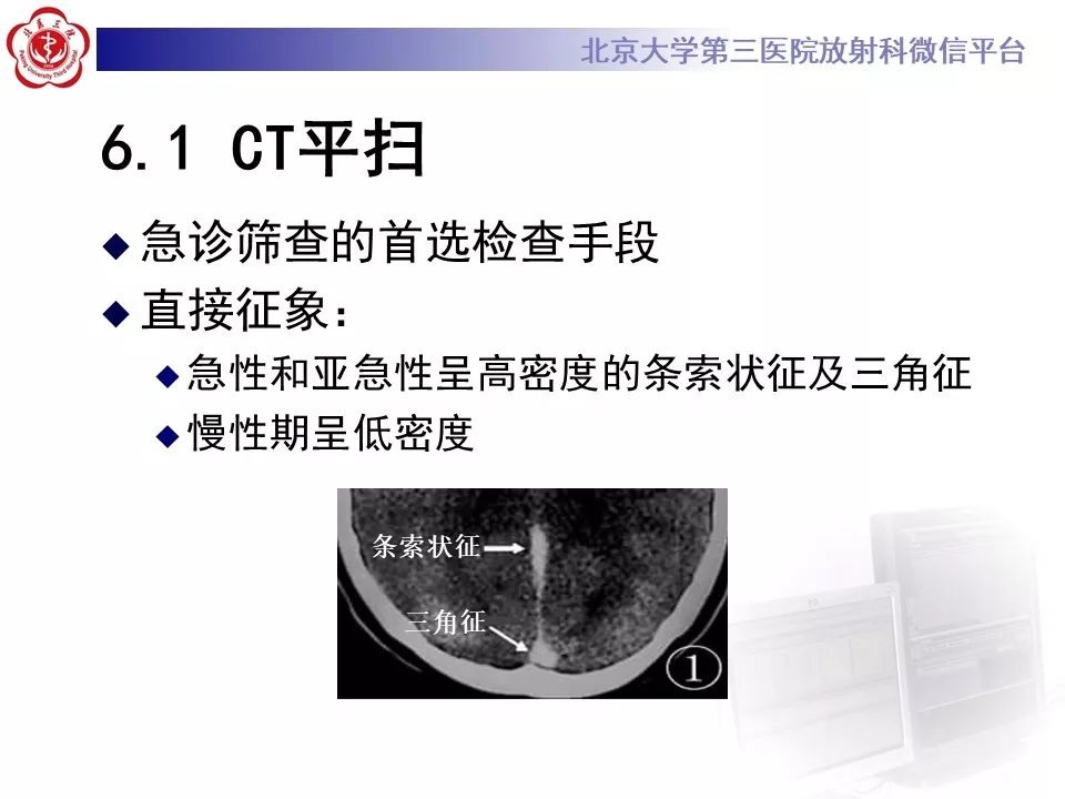 【病例】静脉窦血栓形成1例CT及MR影像