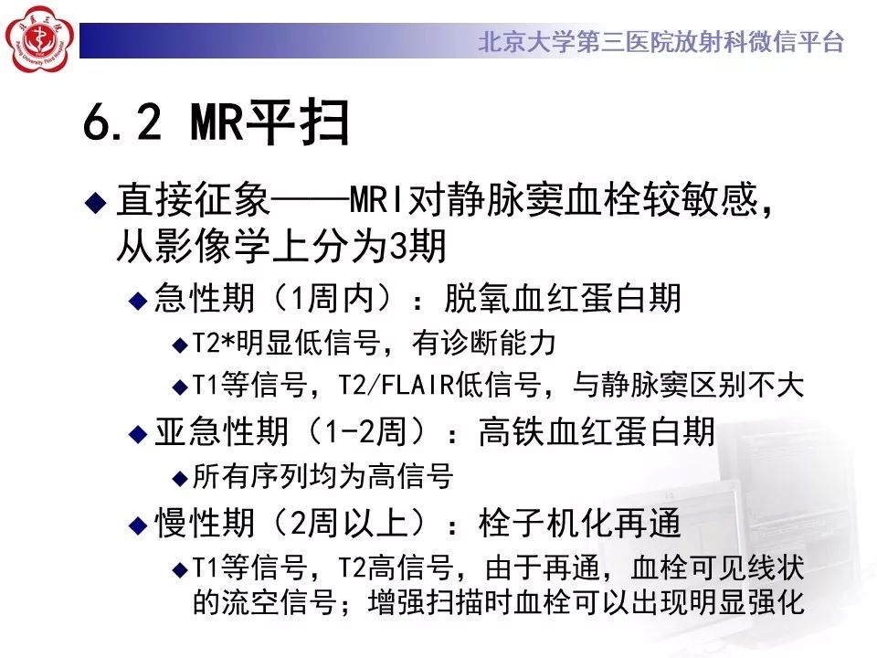 【病例】静脉窦血栓形成1例CT及MR影像
