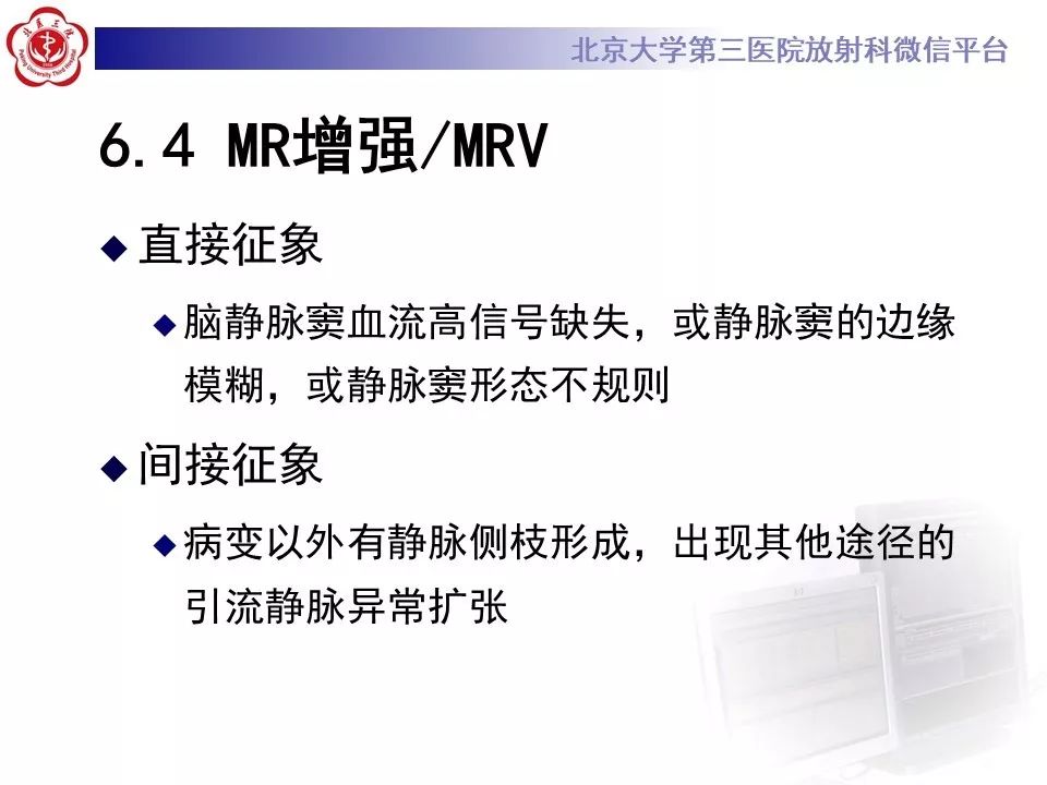 【病例】静脉窦血栓形成1例CT及MR影像