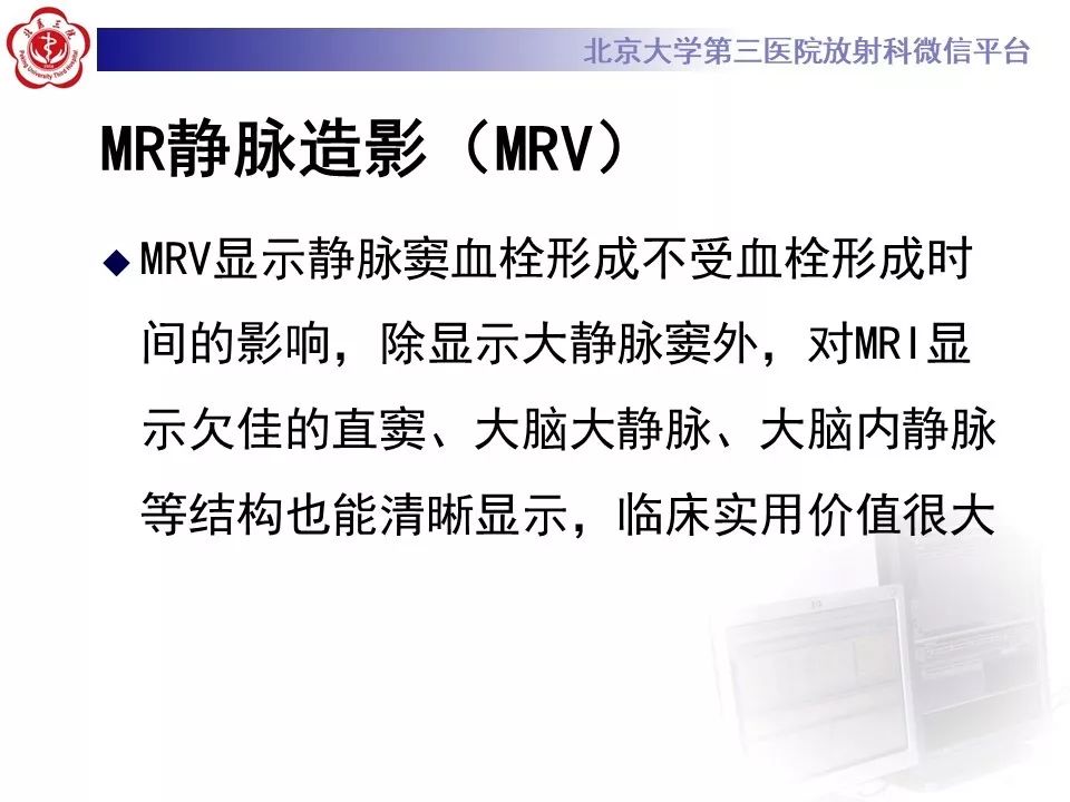【病例】静脉窦血栓形成1例CT及MR影像