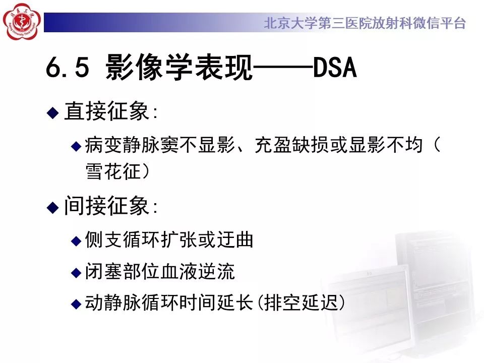 【病例】静脉窦血栓形成1例CT及MR影像