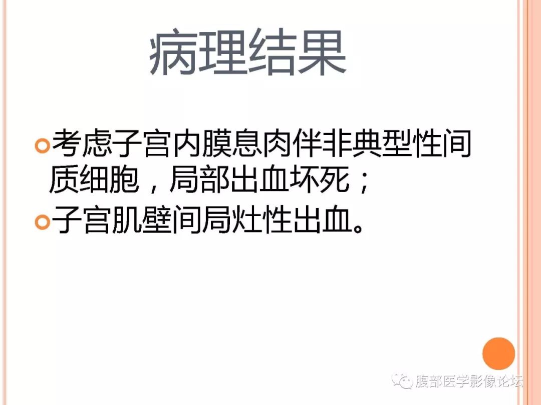 【病例】子宫内膜息肉1例MR影像
