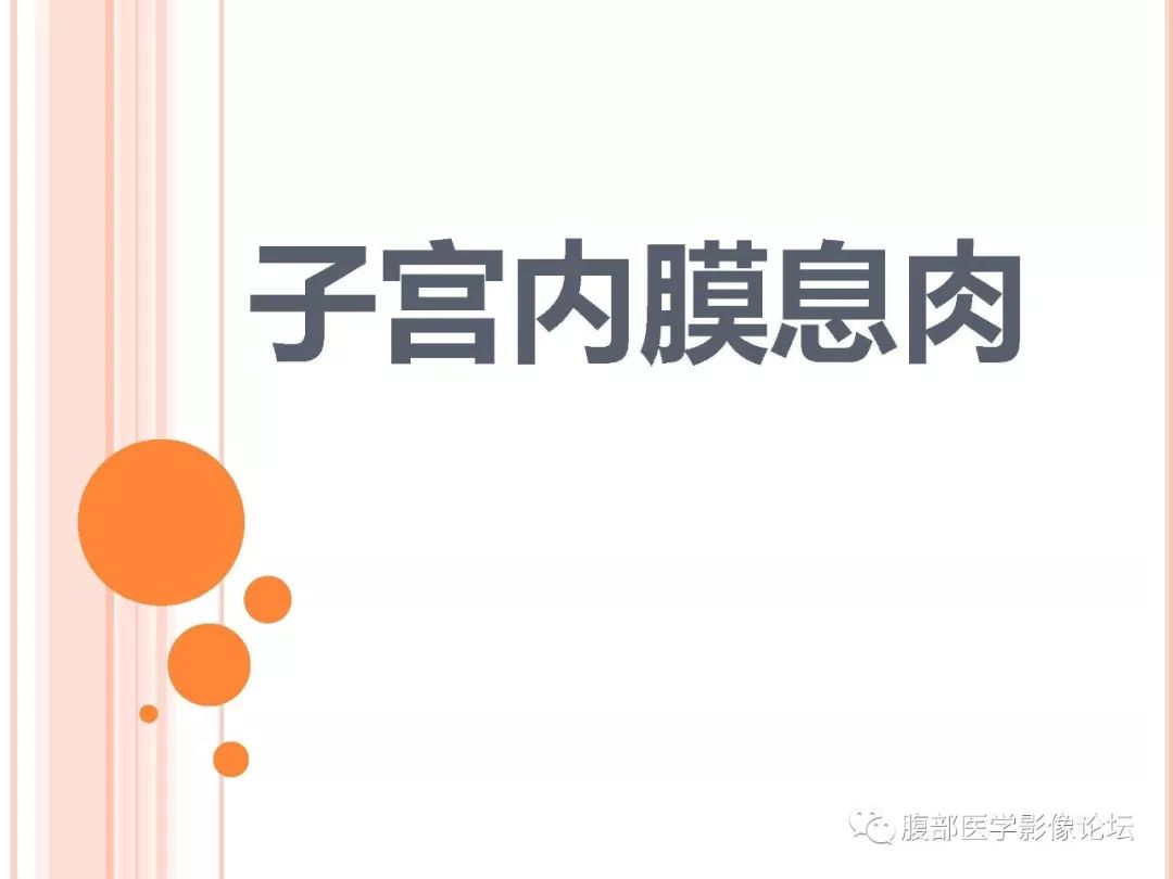 【病例】子宫内膜息肉1例MR影像