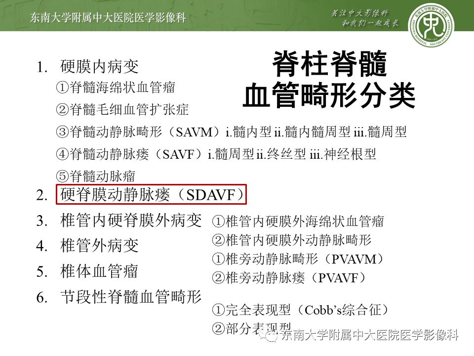 【病例】硬脊膜动静脉瘘1例MR影像