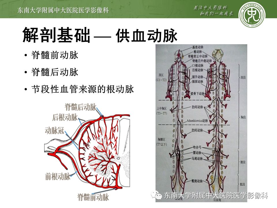 【病例】硬脊膜动静脉瘘1例MR影像