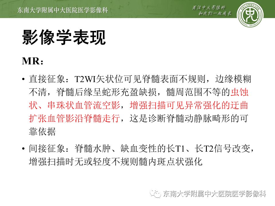 【病例】硬脊膜动静脉瘘1例MR影像