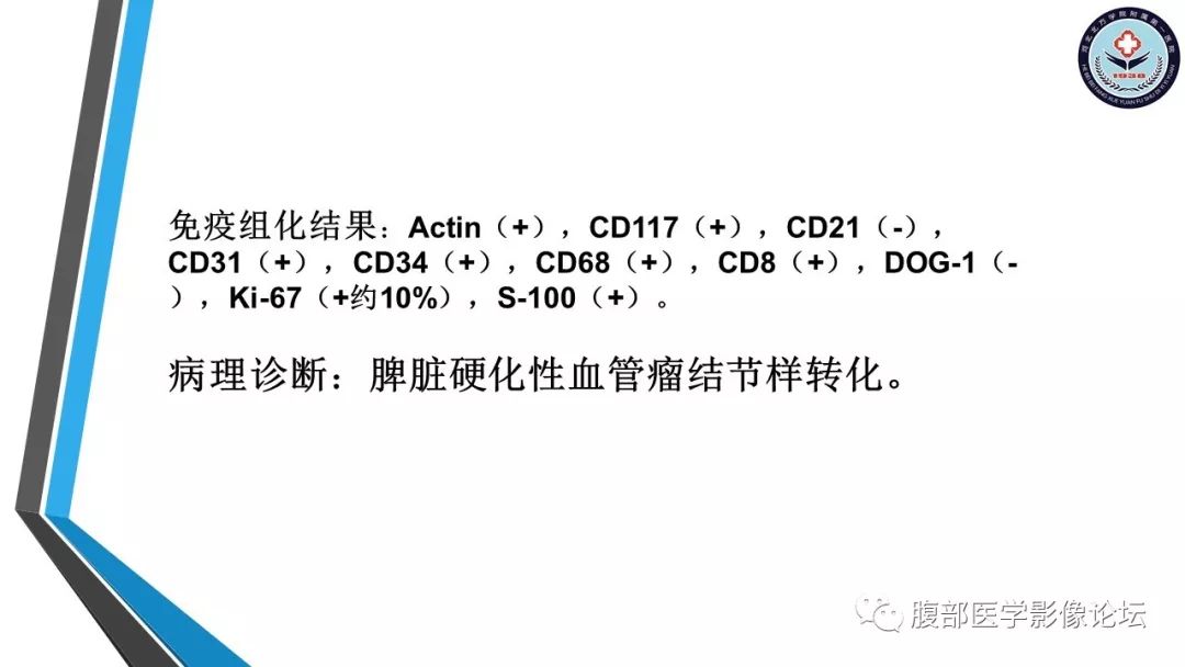 【PPT】脾脏硬化性血管瘤结节样转化