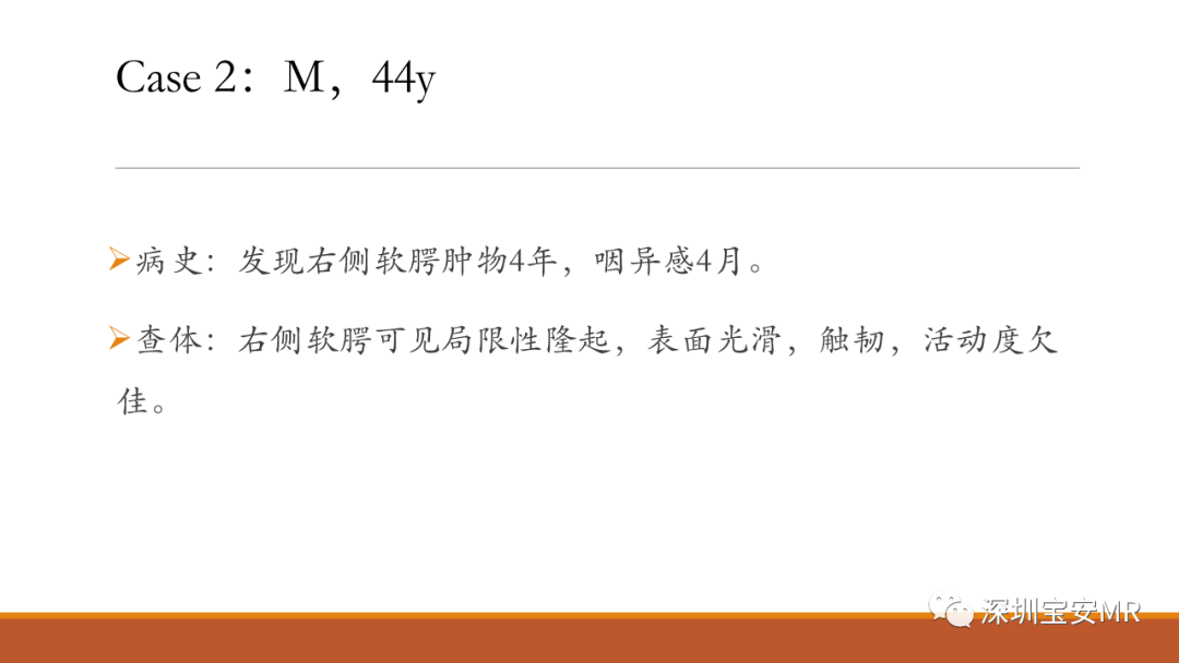 【病例】鼻腔及咽旁多形性腺瘤各1例CT及MR影像