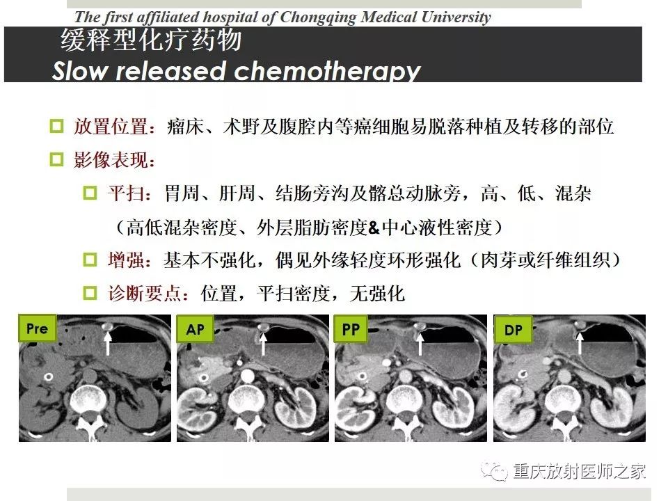 【PPT】胃肠道肿瘤术后影像报告