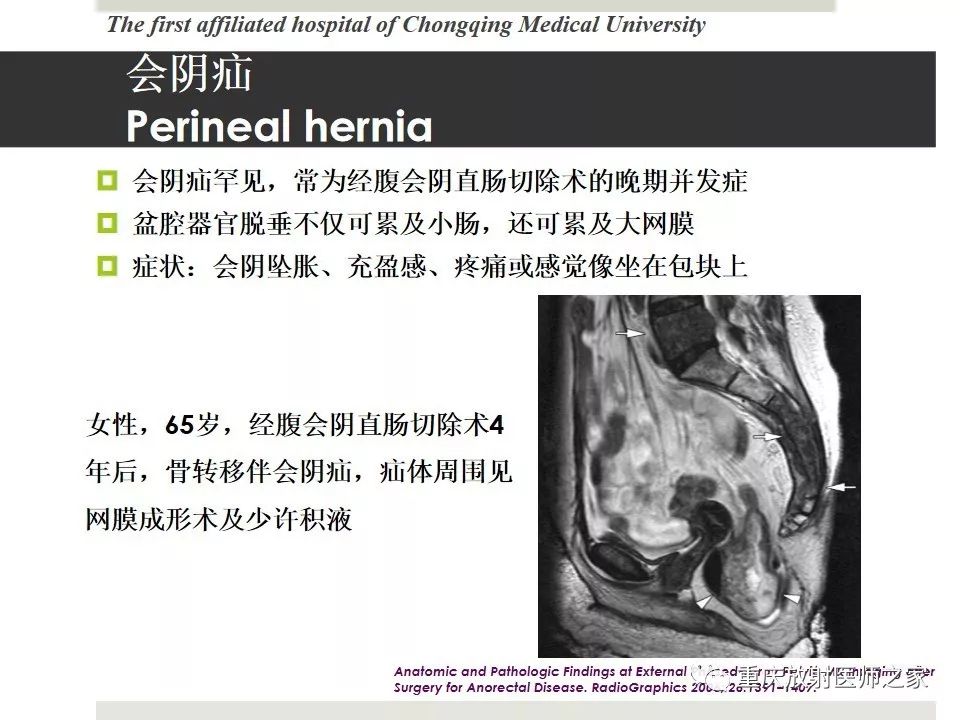 【PPT】胃肠道肿瘤术后影像报告