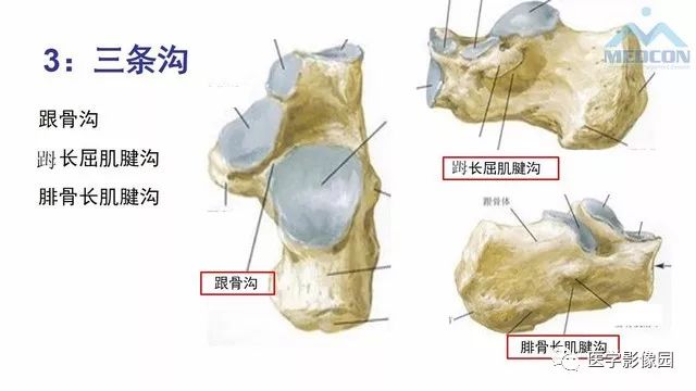 【PPT】跟骨肿瘤及肿瘤样病变影像诊断及鉴别诊断