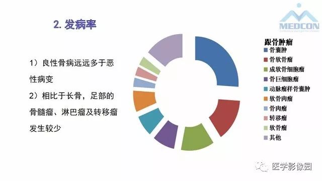 【PPT】跟骨肿瘤及肿瘤样病变影像诊断及鉴别诊断