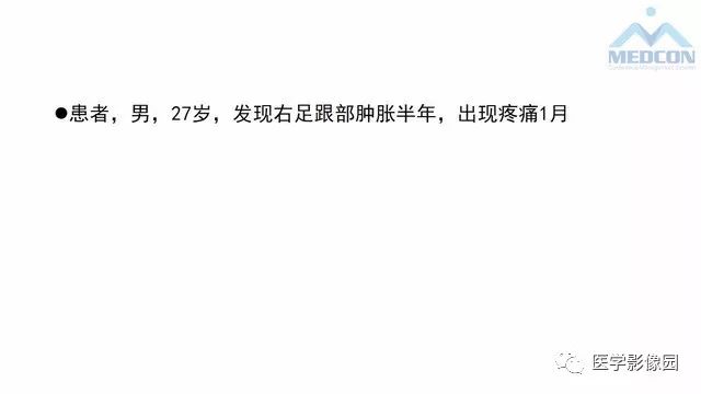 【PPT】跟骨肿瘤及肿瘤样病变影像诊断及鉴别诊断