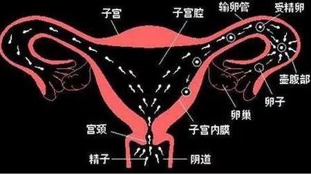 子宫输卵管造影一文搞定 子宫输卵管造影一文搞定