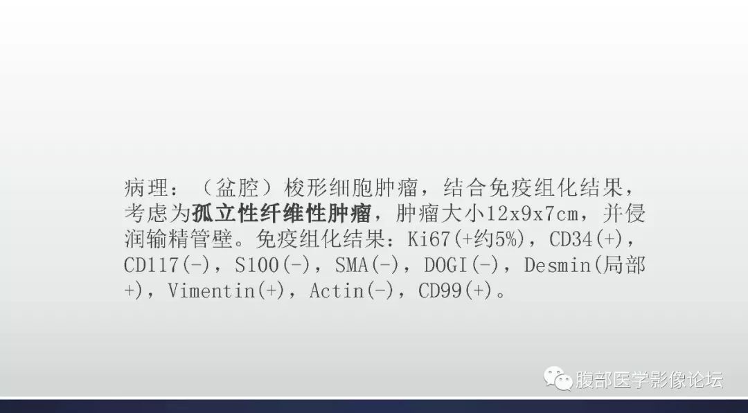 【病例】盆腔孤立性纤维性肿瘤1例CT及MR影像