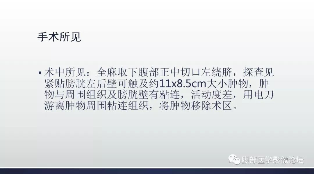 【病例】盆腔孤立性纤维性肿瘤1例CT及MR影像
