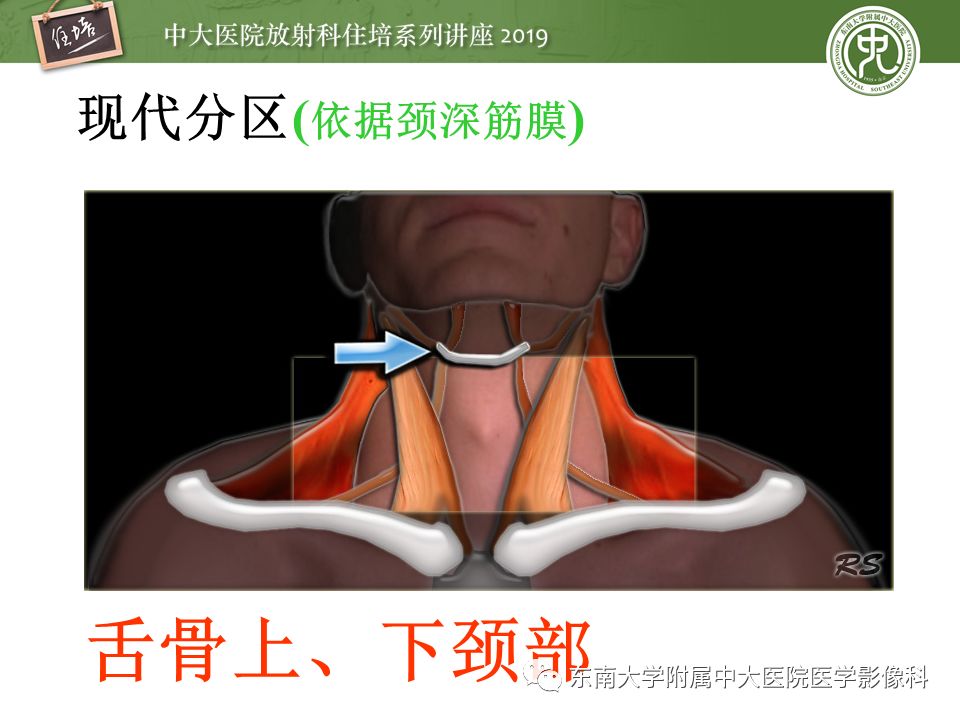 【PPT】颈部间隙的影像解剖及诊断思路