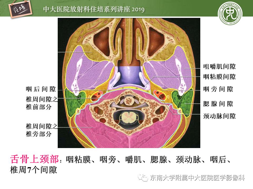 【PPT】颈部间隙的影像解剖及诊断思路