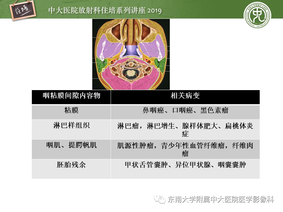 【PPT】颈部间隙的影像解剖及诊断思路