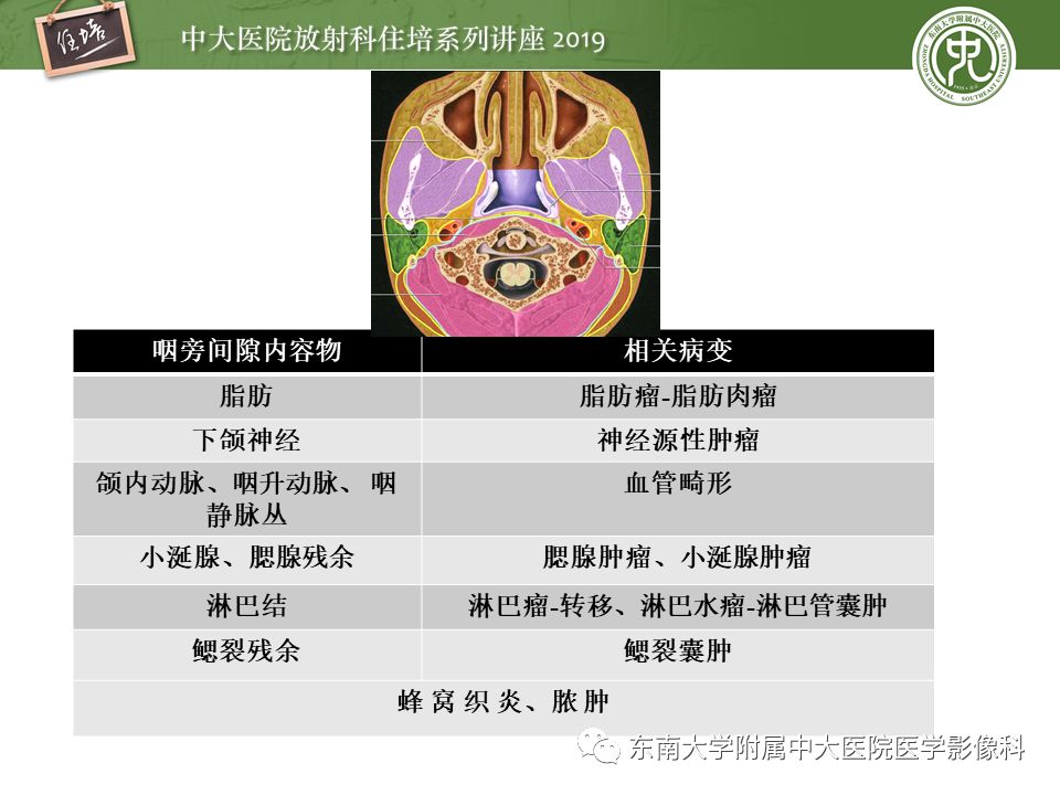 【PPT】颈部间隙的影像解剖及诊断思路