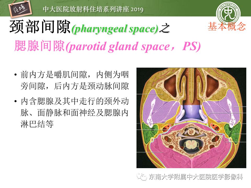 【PPT】颈部间隙的影像解剖及诊断思路