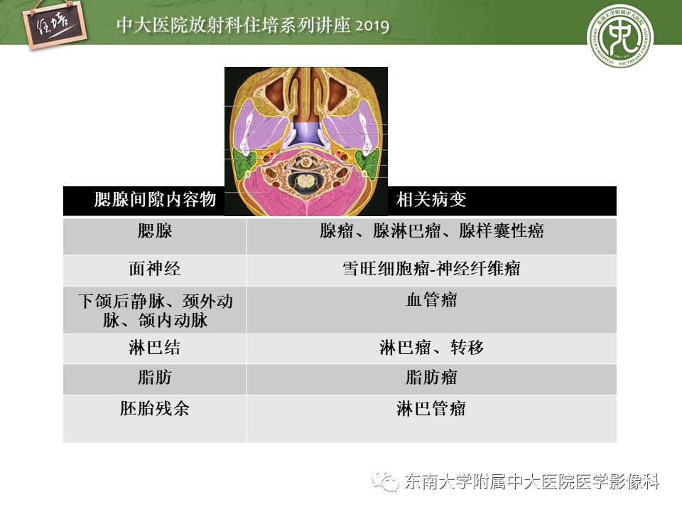 【PPT】颈部间隙的影像解剖及诊断思路