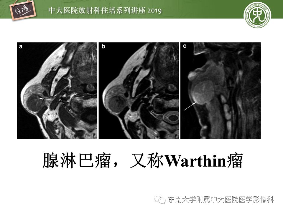 【PPT】颈部间隙的影像解剖及诊断思路
