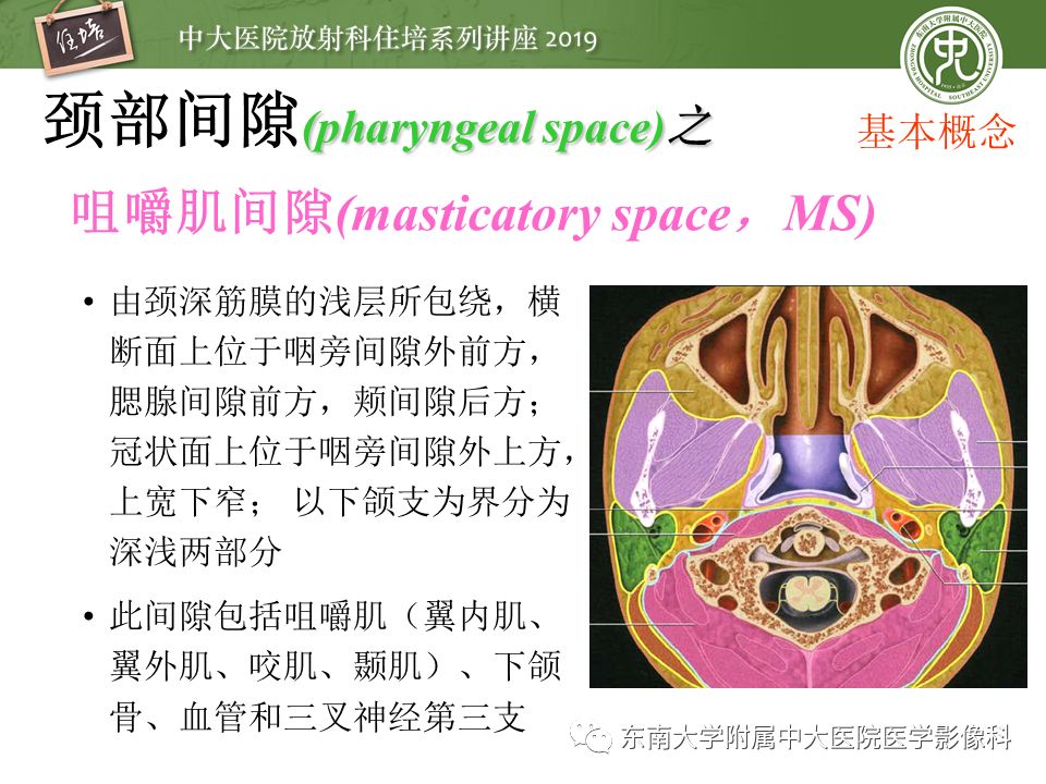 【PPT】颈部间隙的影像解剖及诊断思路